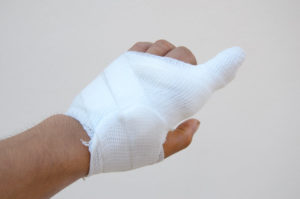 broken finger at work claim